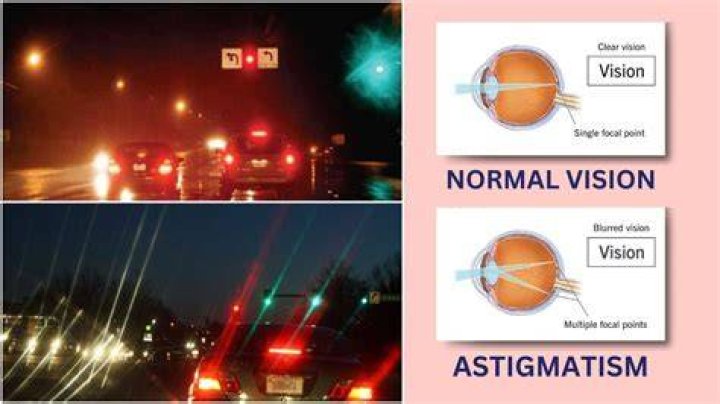 Astigmatism How it can Impact Night Vision and Driving Dr. Jiwani