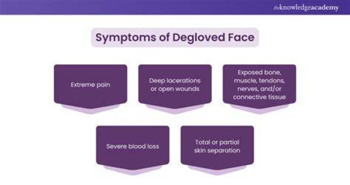 Degloved Face Understanding the Causes and Treatment