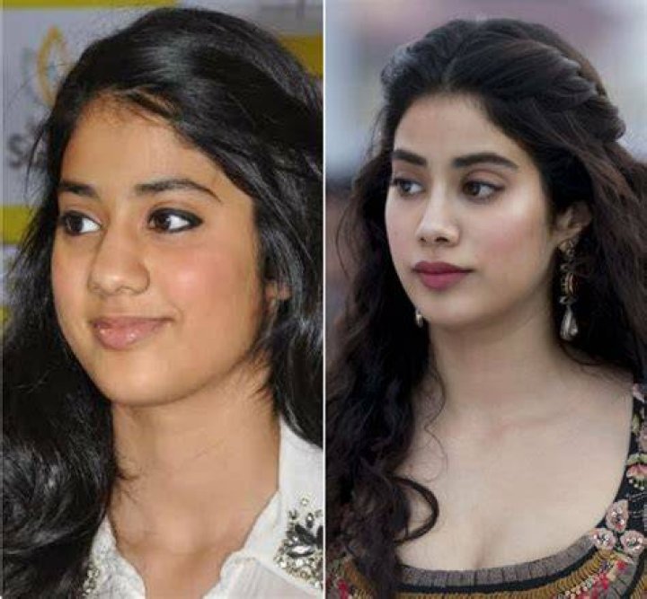 Did Janhvi Kapoor had Eyelid surgery (blepharoplasty) ?? She used to