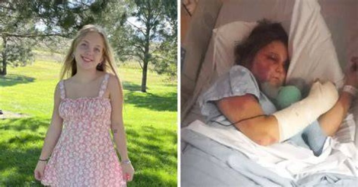 Kirra Hart's Absolute Before And After Transformation What Happened To