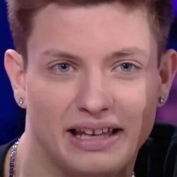 Matt Rife Before New Teeth Did He Wear Braces? Then And Now